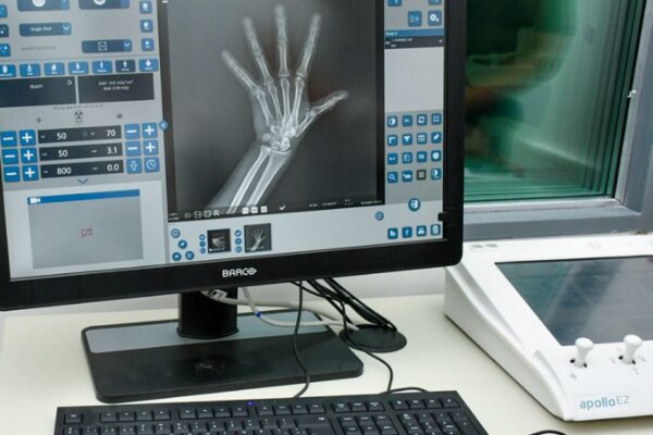 NUEVA TECNOLOGÍA MÉDICA PARA EL HOSPITAL FEDERICO CANTONI DE POCITO